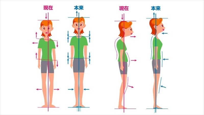 直立時のバランスが悪くなる