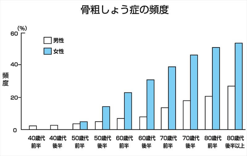 骨が丈夫でないとバイクの重みに耐えられない